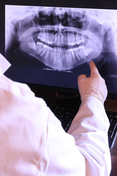 Best Broken or Cracked Tooth Emergency Dentist in Dixon, MO