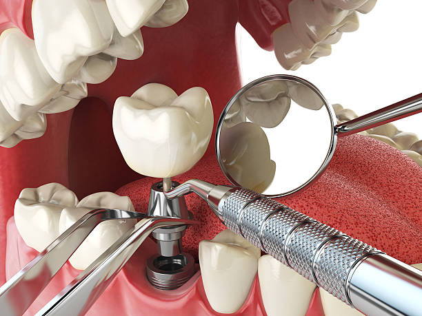 Best Orthodontic Emergency Dentist in Dixon, MO